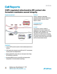 Symmetric arrangement of mitochondria:plasma membrane contacts between  adjacent photoreceptor cells regulated by Opa1