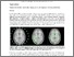 [thumbnail of ismrm2015_abstract_rOiSpace_v6.1.pdf]