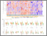 [thumbnail of Complement_ISARIC4C_Siggins_Morgan_Figures_Selected_2022 (1).pdf]